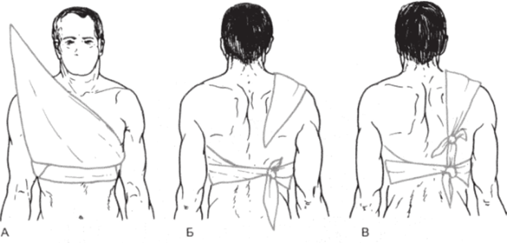 Косыночные повязки на грудь и спину (объяснение в тексте).