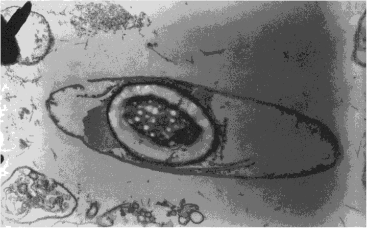 Ультратонкий срез клетки Clostridim butyricum со спорой. Электронная микрофотография (по.