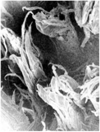 Тактильные рецепторные образования дорсальной поверхности языка взрослого человека (электронная сканирующая микроскопия).