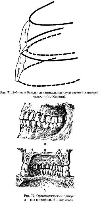 В ортопедической стоматологии принято различать, кроме зубной, альвеолярную и базальную дуги (рис. 71). Под альвеолярной дугой подразумевают линию, проведенную по гребню альвеолярного отростка. Базальная дуга проходит по верхушкам корней и часто называется апикальным базисом. Поскольку на верхней челюсти коронки наклонены кнаружи, а корни внутрь, ее зубная дуга шире альвеолярной, а последняя — шире базальной. Базальная дуга, таким образом, является местом, где сосредоточивается жевательное давление и где берут свое начало контрфорсы. На нижней челюсти, наоборот, вследствие наклона коронок зубов внутрь, а корней — кнаружи зубная дуга уже альвеолярной, а последняя - уже базальной. По этой причине с потерей зубов нижняя челюсть при ее приближении к верхней выступает вперед, создавая видимость прогении (старческая прогения). Ортогнатический прикус, наиболее распространенный среди европейцев (у 79,6%), характеризуется отвесным положением фронтальных зубов или легким отклонением их кпереди и резцовым перекрытием; верхние резцы несколько перекрывают нижние — приблизительно на 1/3 высоты их коронок (рис. 72). Менее распространен прямой прикус. Для него характерно прямое смыкание режущих поверхностей фронтальных зубов.
