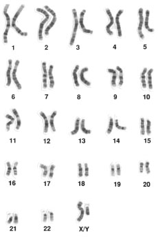 Хромосомы. Закономерности генетики.